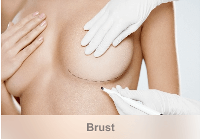 dL PlastischeChirurgie Leistungen Brust