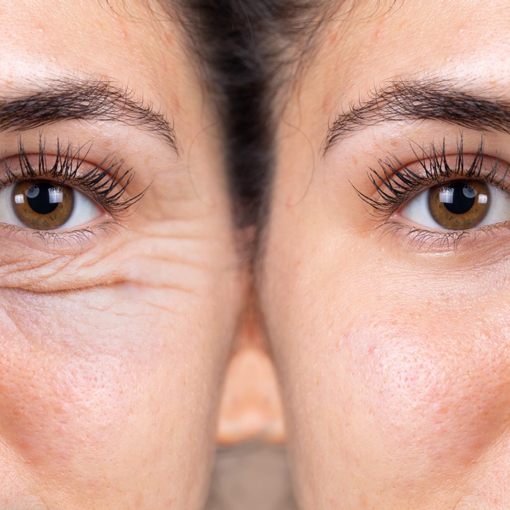 dL PlastischeChirurgie Leistungen Haut Narben