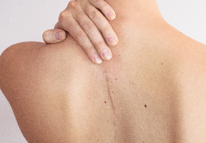 dL PlastischeChirurgie Leistungen Haut Narben