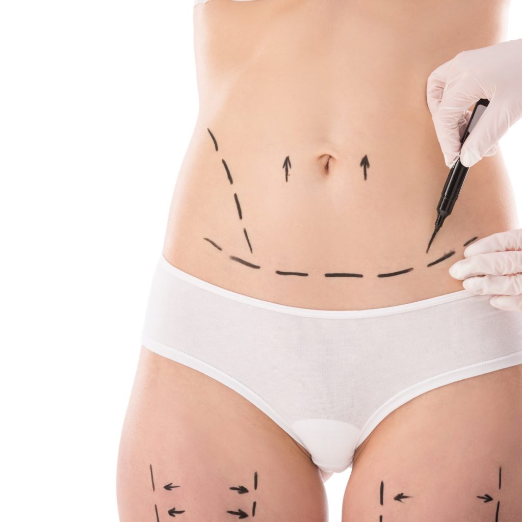 dL PlastischeChirurgie Leistungen Koerper