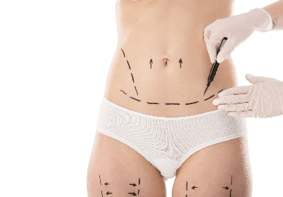 dL PlastischeChirurgie Leistungen korper